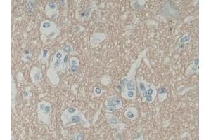 Detection of SNAP25 in Human Cerebrum Tissue using Polyclonal Antibody to Synaptosomal Associated Protein 25 kDa (SNAP25) (SNAP25 anticorps  (AA 1-206))