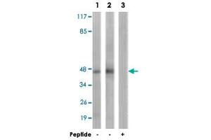Western blot analysis of extracts from HepG2 cells (Lane 1) and K-562 cells (Lane 2 and 3), using PRKAR2B polyclonal antibody . (PRKAR2B anticorps  (Ser113))