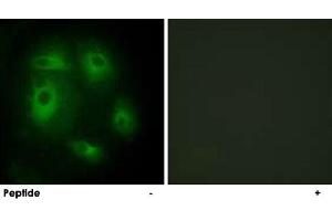 Immunofluorescence analysis of HeLa cells, using DLEC1 polyclonal antibody . (DLEC1 anticorps  (N-Term))