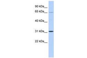 Image no. 1 for anti-Zinc Finger Protein 691 (ZNF691) (C-Term) antibody (ABIN6742831) (ZNF691 anticorps  (C-Term))