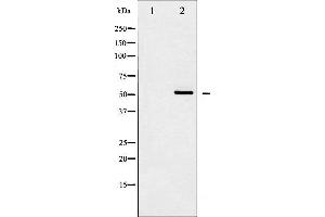 Western blot analysis of Src expression in HeLa whole cell lysates,The lane on the left is treated with the antigen-specific peptide. (Src anticorps  (N-Term))