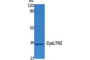 Western Blot (WB) analysis of specific cells using CysLTR2 Polyclonal Antibody. (CasLTR2 anticorps  (C-Term))