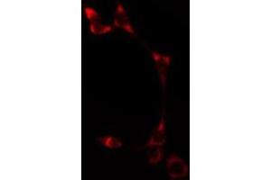 ABIN6275513 staining  HT29 cells by IF/ICC. (ATP2A1/SERCA1 anticorps  (Internal Region))