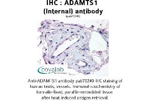Image no. 1 for anti-ADAM Metallopeptidase with Thrombospondin Type 1 Motif, 1 (ADAMTS1) (Internal Region) antibody (ABIN1731522) (ADAMTS1 anticorps  (Internal Region))