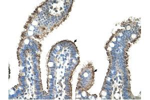MMP1 antibody was used for immunohistochemistry at a concentration of 4-8 ug/ml to stain Epithelial cells of intestinal villus (arrows) in Human Intestine. (MMP1 anticorps)