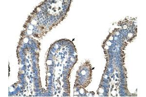 MMP1 antibody was used for immunohistochemistry at a concentration of 4-8 ug/ml to stain Epithelial cells of intestinal villus (arrows) in Human Intestine.