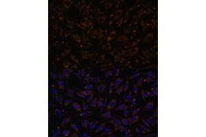 anti-Plasmolipin (AA 1-100) antibody