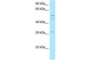 Image no. 1 for anti-Chromosome 11 Open Reading Frame 42 (C11ORF42) (AA 259-308) antibody (ABIN6747983) (C11ORF42 anticorps  (AA 259-308))