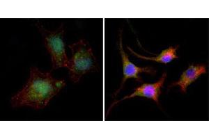 Immunofluorescence analysis of A549 (left) and SK-BR-3 (right) cells using CTNNB1 mouse mAb (green). (CTNNB1 anticorps)