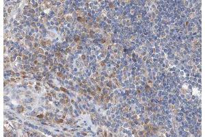 ABIN6266555 at 1/100 staining human lymph node tissue sections by IHC-P.