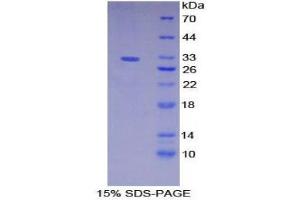 SDS-PAGE (SDS) image for Meprin A, alpha (PABA Peptide Hydrolase) (MEP1A) (AA 219-463) protein (His tag) (ABIN1879557)