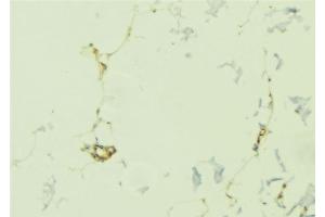 ABIN6276785 at 1/100 staining Human lung tissue by IHC-P. (OLR1 anticorps  (N-Term))