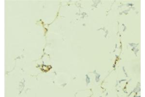 ABIN6276785 at 1/100 staining Human lung tissue by IHC-P.