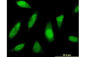 Immunofluorescence of monoclonal antibody to PTTG1IP on HeLa cell.