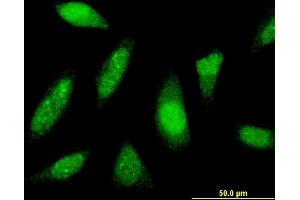 Immunofluorescence of monoclonal antibody to PTTG1IP on HeLa cell. (PTTG1IP anticorps  (AA 1-180))