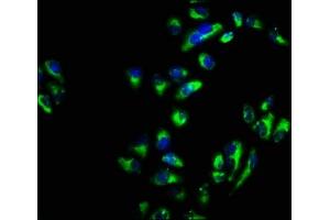 Immunofluorescence staining of Hela cells with ABIN7171142 at 1:66, counter-stained with DAPI. (SNAP23 anticorps  (AA 90-196))