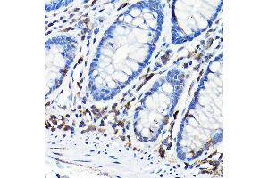 Immunohistochemistry of paraffin-embedded mouse spleen using NLRP1 Rabbit pAb (ABIN7268935) at dilution of 1:100 (40x lens). (NLRP1 anticorps  (AA 1000-1100))