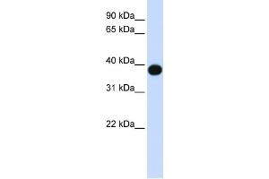 WB Suggested Anti-DEGS1 Antibody Titration:  0. (DEGS1 anticorps  (N-Term))