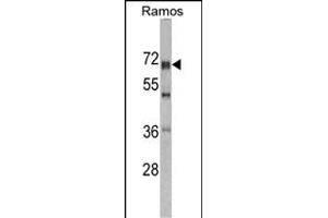 Western blot analysis of DDX5 antibody (Center) (ABIN391669 and ABIN2841580) in Romas cell line lysates (35 μg/lane). (DDX5 anticorps  (AA 306-334))