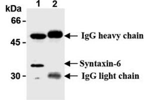 Western Blotting (WB) image for anti-Syntaxin 6 (STX6) antibody (ABIN492572)