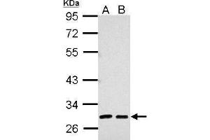 WB Image Sample (30 ug of whole cell lysate) A: 293T B: A431 10% SDS PAGE antibody diluted at 1:5000 (AMBP anticorps)