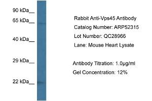 Western Blotting (WB) image for anti-Vacuolar Protein Sorting 45 (VPS45) (C-Term) antibody (ABIN2784878) (VPS45 anticorps  (C-Term))