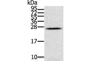 Western blot analysis of Human ovarian cancer, using IFNL3 Polyclonal Antibody at dilution of 1:350 (IL28B anticorps)