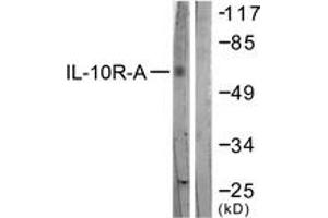 Western blot analysis of extracts from HepG2 cells, treated with Na2VO3 0. (IL-10RA anticorps  (AA 462-511))