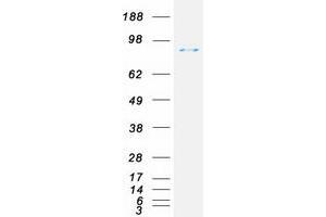Validation with Western Blot
