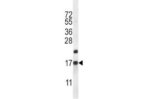 Western Blotting (WB) image for anti-CART Prepropeptide (CARTPT) antibody (ABIN2996828) (CARTPT anticorps)