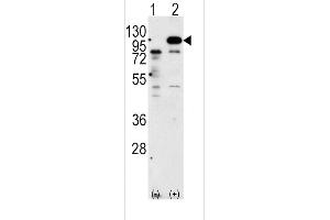 Western blot analysis of P (arrow) using rabbit polyclonal P Antibody (C-term) 6306b.