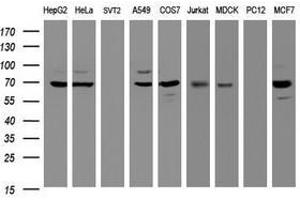 Image no. 6 for anti-Galactosidase, beta 1 (GLB1) antibody (ABIN1498467)