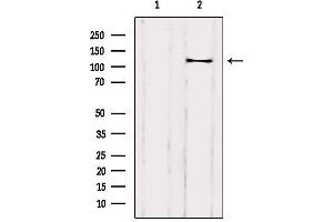 Western blot analysis of extracts from Rat heart, using DAAM1 Antibody. (DAAM1 anticorps  (Internal Region))