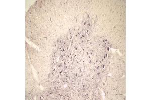 IHC on rat spinal cord using Rabbit antibody to extracellular, N-terminal part of Sortilin (Neurotensin receptor 3, NTR3, Sort1): IgG (ABIN350868) at a concentration of 10 µg/ml. (Sortilin 1 anticorps)