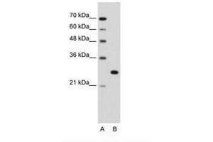 Image no. 2 for anti-Forkhead Box R2 (FOXR2) (AA 82-131) antibody (ABIN203387) (FOXR2 anticorps  (AA 82-131))