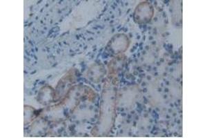 Detection of PAI2 in Rat Kidney Tissue using Monoclonal Antibody to Plasminogen Activator Inhibitor 2 (PAI2) (SERPINB2 anticorps  (AA 154-408))