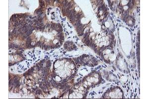 Image no. 5 for anti-Phosphoinositide-3-Kinase, Regulatory Subunit 5 (PIK3R5) antibody (ABIN1500212)