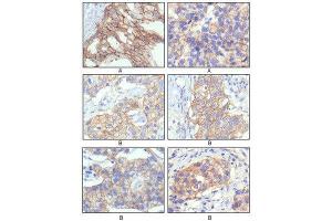 Immunohistochemistry (IHC) image for anti-Receptor tyrosine-protein kinase erbB-2 (ErbB2/Her2) antibody (ABIN1845273) (ErbB2/Her2 anticorps)