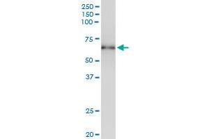 Immunoprecipitation of STK17A transfected lysate using anti-STK17A MaxPab rabbit polyclonal antibody and Protein A Magnetic Bead , and immunoblotted with STK17A MaxPab mouse polyclonal antibody (B01) .