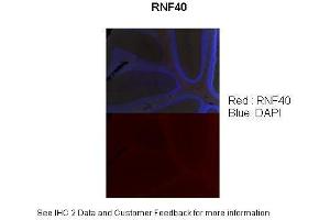 Sample Type :  Adult mouse cerebellum (l0x) section  Primary Antibody Dilution :  1:100  Secondary Antibody :  Donkey Anti-rabbit (568 nm)  Secondary Antibody Dilution :  1:500  Color/Signal Descriptions :  RNF40: Red DAPI:Blue  Gene Name :  RNF40  Submitted by :  Anonymous (RNF40 anticorps  (C-Term))