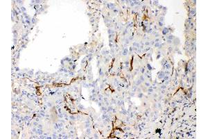 IHC analysis of Bcl-XL using anti-Bcl-XL antibody .