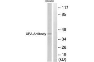 Western blot analysis of extracts from COLO205 cells, using XPA Antibody. (PA (AA 211-260) anticorps)