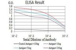 Black line: Control Antigen (100 ng),Purple line: Antigen (10 ng), Blue line: Antigen (50 ng), Red line:Antigen (100 ng)