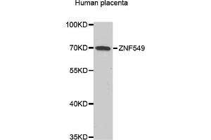 Western blot analysis of extracts of Human placenta, using ZNF549 antibody (ABIN6293799) at 1:1000 dilution. (ZNF549 anticorps)