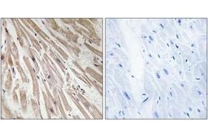Immunohistochemistry analysis of paraffin-embedded human heart tissue, using ARPP21 Antibody.