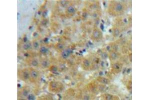 IHC-P analysis of Liver tissue, with DAB staining. (OLR1 anticorps  (AA 60-312))