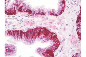 Anti-NCBP1 / CBP80 antibody IHC staining of human prostate. (NCBP1 anticorps  (Internal Region))