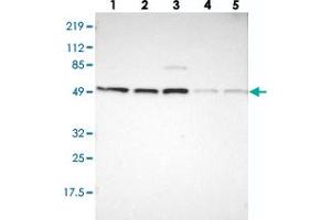 Western blot analysis of Lane 1: RT-4, Lane 2: U-251 MG, Lane 3: A-431, Lane 4: Liver, Lane 5: Tonsil with PSMC1 polyclonal antibody  at 1:250-1:500 dilution.