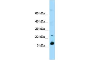 Western Blotting (WB) image for anti-Regenerating Islet-Derived 1 (REG1) (Middle Region) antibody (ABIN2789530)