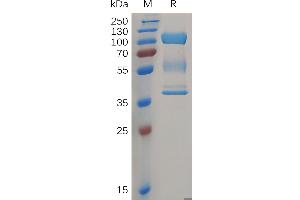 Human ZP3 Protein, hFc Tag on SDS-PAGE under reducing condition.